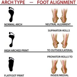 foot-alingment-arch-type-diagram